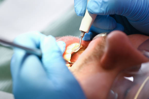 Best Weekend Emergency Dentist in Soquel, CA