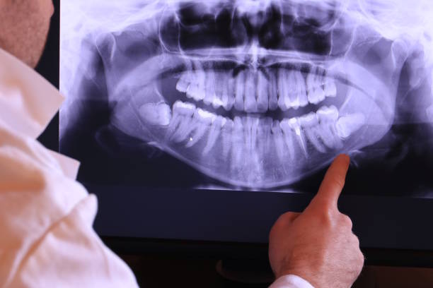 Best Emergency Broken Tooth Repair in Soquel, CA
