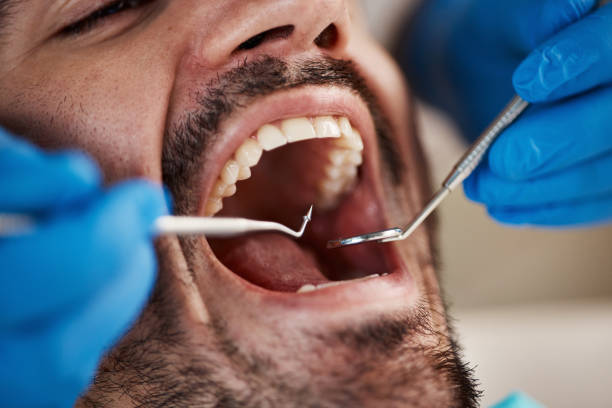 Best Emergency Dental Care for Trauma or Injury in Soquel, CA